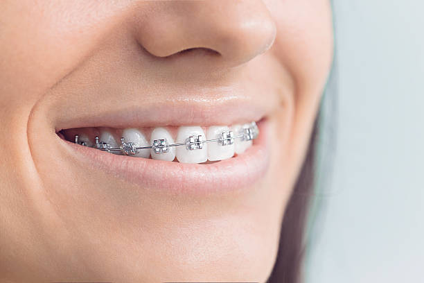 Best Teeth Whitening  in Henderson, GA